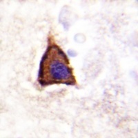 Beta-2 Adrenergic Receptor (Phospho-S355/S356) Rabbit Polyclonal Antibody