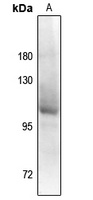 Androgen Receptor (Phospho-S94) Rabbit Polyclonal Antibody