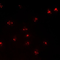 Androgen Receptor (Phospho-S94) Rabbit Polyclonal Antibody