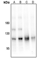 PKC mu (Phospho-S205) Rabbit Polyclonal Antibody