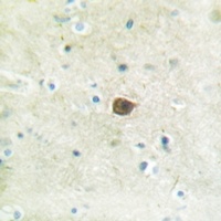 PKC mu (Phospho-S205) Rabbit Polyclonal Antibody