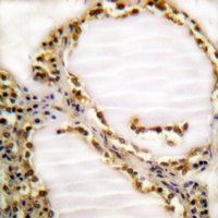 RB1 (Phospho-T821) Rabbit Polyclonal Antibody