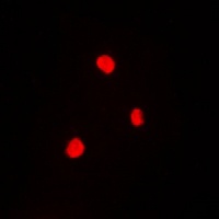 RB1 (Phospho-T821) Rabbit Polyclonal Antibody