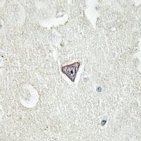 L1CAM (Phospho-S1181) Rabbit Polyclonal Antibody