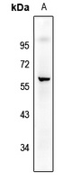 CD226 (Phospho-S329) Rabbit Polyclonal Antibody
