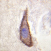 CD226 (Phospho-S329) Rabbit Polyclonal Antibody