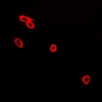 CD226 (Phospho-S329) Rabbit Polyclonal Antibody