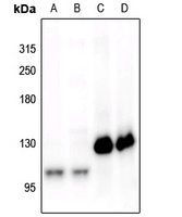 CD115 (Phospho-Y561) Rabbit Polyclonal Antibody