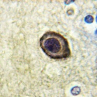 CD115 (Phospho-Y561) Rabbit Polyclonal Antibody