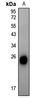Alpha-crystallin B (Phospho-S59) Rabbit Polyclonal Antibody