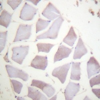 Alpha-crystallin B (Phospho-S59) Rabbit Polyclonal Antibody