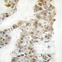 DNA-PKcs (Phospho-S2056) Rabbit Polyclonal Antibody