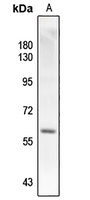 SMAD2 (Phospho-T220) Rabbit Polyclonal Antibody