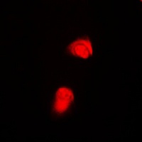 SMAD2 (Phospho-T220) Rabbit Polyclonal Antibody