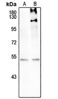 SMAD3 (Phospho-S208) Rabbit Polyclonal Antibody