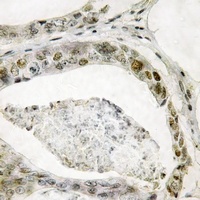 SMAD3 (Phospho-S208) Rabbit Polyclonal Antibody