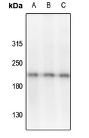 VEGFR2/3 (Phospho-Y1054/Y1063) Rabbit Polyclonal Antibody