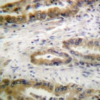 VEGFR2/3 (Phospho-Y1054/Y1063) Rabbit Polyclonal Antibody
