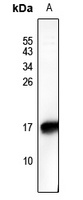 HMGN2 (Phospho-S29) Rabbit Polyclonal Antibody
