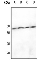 hnRNP D0 (Phospho-S83) Rabbit Polyclonal Antibody