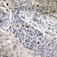 hnRNP D0 (Phospho-S83) Rabbit Polyclonal Antibody