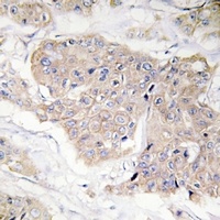 CD124 (Phospho-Y497) Antibody