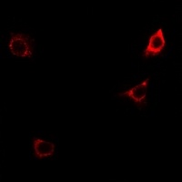CD124 (Phospho-Y497) Antibody