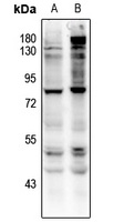 CD127 (Phospho-Y449) Antibody