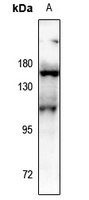 Aconitase 1 (Phospho-S138) Rabbit Polyclonal Antibody