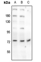 Beta-NaCH (Phospho-T615) Rabbit Polyclonal Antibody