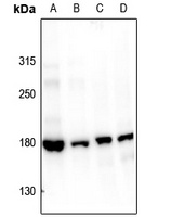 Topoisomerase 2 alpha (Phospho-S1106) Rabbit Polyclonal Antibody