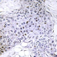 Topoisomerase 2 alpha (Phospho-S1106) Rabbit Polyclonal Antibody