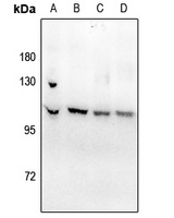 ATP1A1 (Phospho-S23) Rabbit Polyclonal Antibody