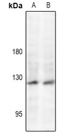 JAK2 (Phospho-Y221) Rabbit Polyclonal Antibody