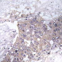 JAK2 (Phospho-Y221) Rabbit Polyclonal Antibody