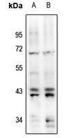 ERK1/2 (Phospho-Y204) Rabbit Polyclonal Antibody