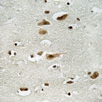 ERK1/2 (Phospho-Y204) Rabbit Polyclonal Antibody