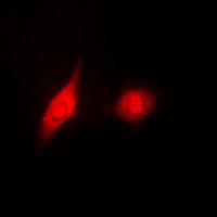 ERK1/2 (Phospho-Y204) Rabbit Polyclonal Antibody