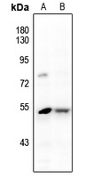 JNK1/2/3 (Phospho-Y185) Rabbit Polyclonal Antibody