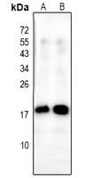Alpha-synuclein (Phospho-Y136) Rabbit Polyclonal Antibody