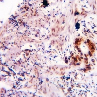 Alpha-synuclein (Phospho-Y136) Rabbit Polyclonal Antibody