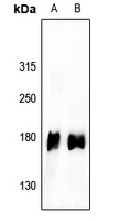 EGFR (Phospho-Y1110) Rabbit Polyclonal Antibody