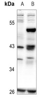CREB (Phospho-S111) Rabbit Polyclonal Antibody