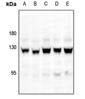 Focal Adhesion Kinase (Phospho-S843) Rabbit Polyclonal Antibody
