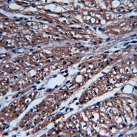 Focal Adhesion Kinase (Phospho-S843) Rabbit Polyclonal Antibody