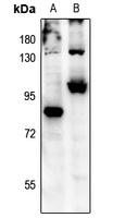 FOXO3 (Phospho-S315) Rabbit Polyclonal Antibody