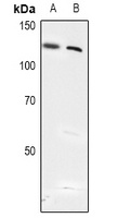 USP28 (Phospho-S714) Rabbit Polyclonal Antibody