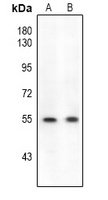 ETS1 (Phospho-S282) Rabbit Polyclonal Antibody