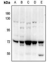 PAK4/5 Rabbit Polyclonal Antibody