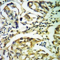 PAK4/5 Rabbit Polyclonal Antibody